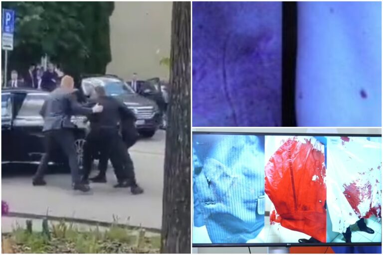 Zakrvavená košeľa, jazvy a zranenia na bruchu. Kaliňák a Gašpar ukázali zranenia Fica po atentáte – VIDEO, FOTO