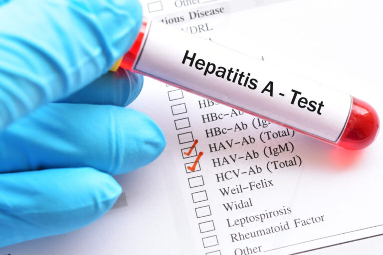Farmaceutka varuje: Hepatitída A nie je len choroba detí a ľudí bez hygieny, riziko číha aj v MHD