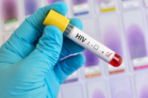 Injekcia, ktorá zastavila HIV: Nový liek má 100-percentnú účinnosť v prevencii AIDS