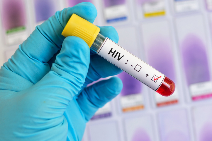 Injekcia, ktorá zastavila HIV: Nový liek má 100-percentnú účinnosť v prevencii AIDS